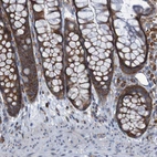 Immunohistochemical staining of human colon shows strong cytoplasmic positivity in glandular cells.