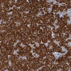 Immunohistochemical staining of human pancreas shows strong cytoplasmic positivity in exocrine glandular cells.