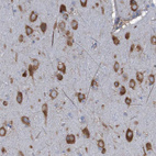 Anti-RPL10 Antibody