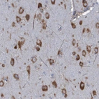 Immunohistochemical staining of human cerebral cortex shows moderate to strong cytoplasmic positivity in neurons.