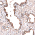 Anti-ACSL3 Antibody