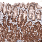 Immunohistochemical staining of human stomach shows moderate cytoplasmic positivity in glandular cells.