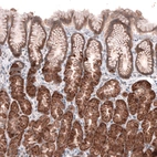 Immunohistochemical staining of human stomach shows moderate cytoplasmic positivity in glandular cells.