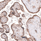 Immunohistochemical staining of human placenta shows moderate cytoplasmic positivity in trophoblastic cells.