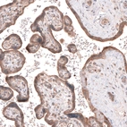 Immunohistochemical staining of human placenta shows moderate cytoplasmic positivity in trophoblastic cells.