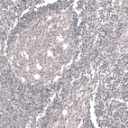Immunohistochemical staining of human tonsil shows no positivity in lymphoid cells as expected.