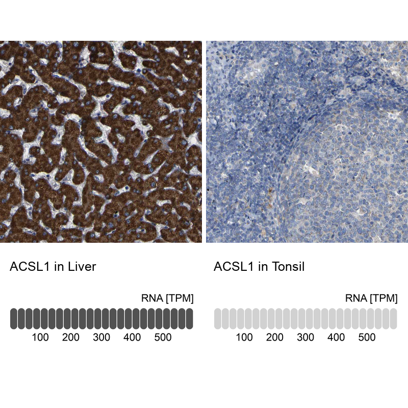 Anti-ACSL1 Antibody