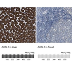 Anti-ACSL1 Antibody