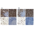 Immunohistochemical staining of human kidney, liver, soft tissues and tonsil using Anti-ACSL1 antibody HPA011316 (A) shows similar protein distribution across tissues to independent antibody HPA011964 (B).