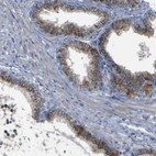 Immunohistochemical staining of human prostate shows moderate granular cytoplasmic positivity in glandular cells.