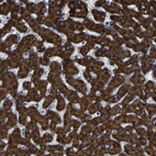 Immunohistochemical staining of human liver shows strong granular cytoplasmic positivity in hepatocytes.