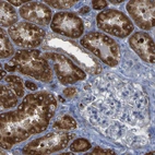 Immunohistochemical staining of human kidney shows moderate granular cytoplasmic positivity in cells in tubules.