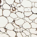 Immunohistochemical staining of human soft tissues shows strong cytoplasmic positivity in adipocytes.