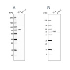 Western blot analysis using Anti-ACSL1 antibody HPA011316 (A) shows similar pattern to independent antibody HPA011964 (B).