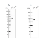 Western blot analysis using Anti-ACSL1 antibody HPA011316 (A) shows similar pattern to independent antibody HPA011964 (B).