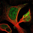 Immunofluorescent staining of human cell line U-2 OS shows localization to nucleoplasm.
