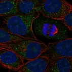 Immunofluorescent staining of human cell line RT-4 shows localization to vesicles.
