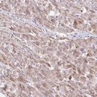 Anti-TMEM246 Antibody