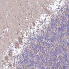 Immunohistochemical staining of human cerebellum shows weak granular cytoplasmic positivity in Purkinje cells.