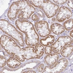 Immunohistochemical staining of human kidney shows moderate granular cytoplasmic positivity in cells in tubules.