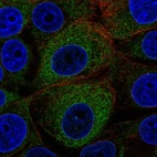 Immunofluorescent staining of human cell line MCF7 shows localization to endoplasmic reticulum.