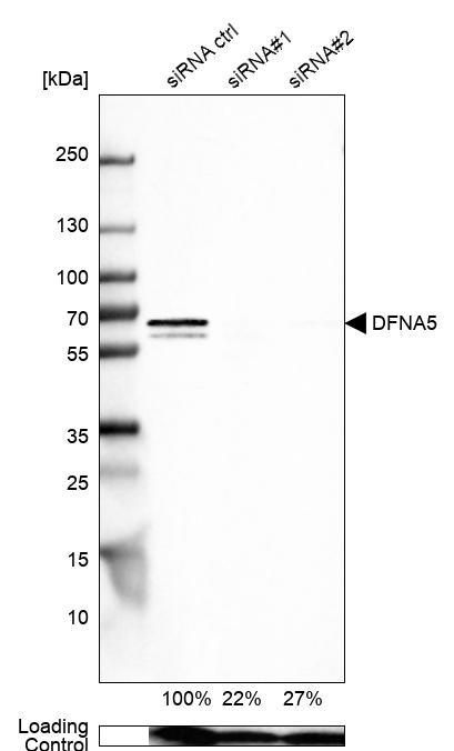 Anti-DFNA5 Antibody