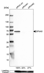 Anti-DFNA5 Antibody