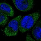 Immunofluorescent staining of human cell line A-431 shows localization to cytosol.