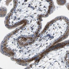 Anti-IGF2R Antibody