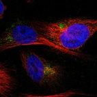 Immunofluorescent staining of human cell line U-251 MG shows localization to the Golgi apparatus.