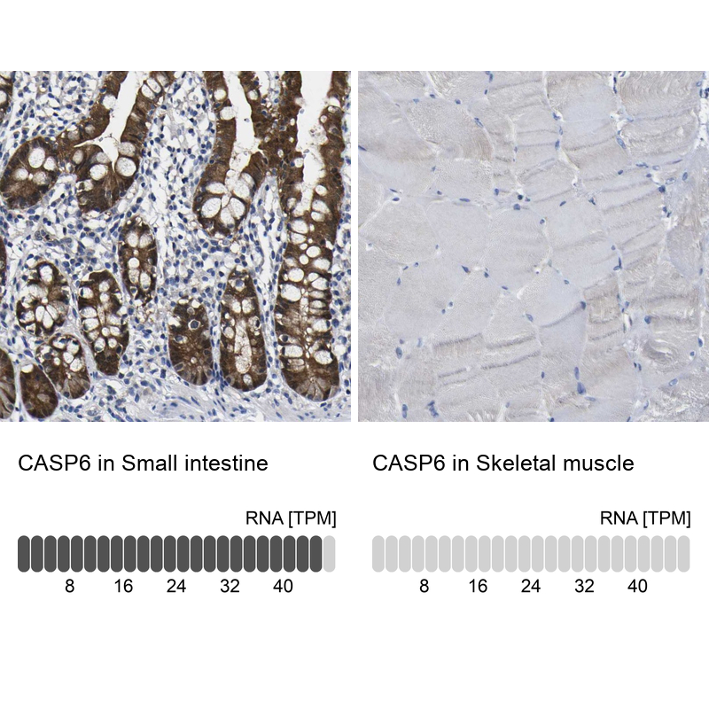 Anti-CASP6 Antibody