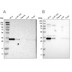Western blot analysis using Anti-CASP6 antibody HPA011337 (A) shows similar pattern to independent antibody HPA024303 (B).
