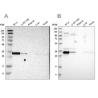 Western blot analysis using Anti-CASP6 antibody HPA011337 (A) shows similar pattern to independent antibody HPA024303 (B).