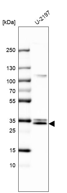 Anti-MGLL Antibody