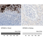 Anti-SPINK5 Antibody