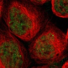 Immunofluorescent staining of human cell line A-431 shows localization to nucleoplasm & nuclear bodies.