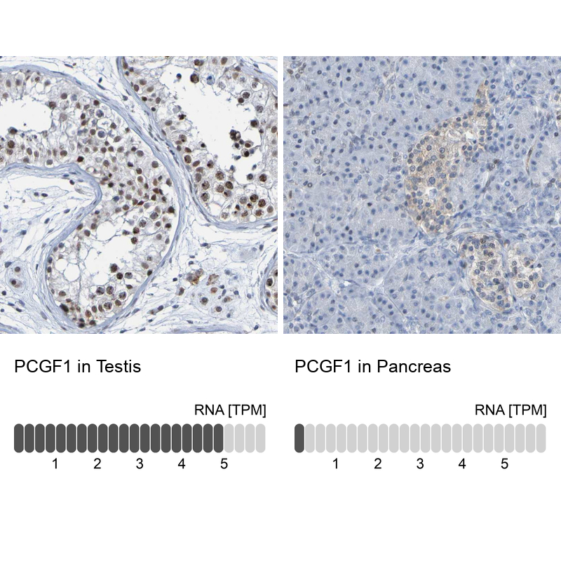 Anti-PCGF1 Antibody