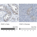 Anti-PCGF1 Antibody
