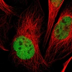 Immunofluorescent staining of human cell line U-2 OS shows localization to nucleoplasm.