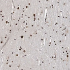 Immunohistochemical staining of human cerebral cortex shows strong nuclear positivity in neurons and glial cells.