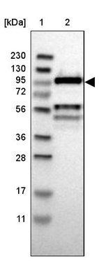 Lane 1: Marker [kDa] 230, 130, 95, 72, 56, 36, 28, 17, 11_br/_Lane 2: Human cell line RT-4