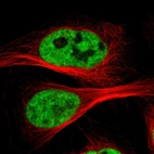 Immunofluorescent staining of human cell line U-2 OS shows localization to nucleoplasm.
