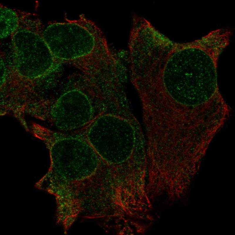 Anti-TRAK1 Antibody