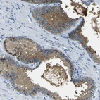 Immunohistochemical staining of human prostate shows high expression.