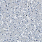 Immunohistochemical staining of human liver shows low expression as expected.