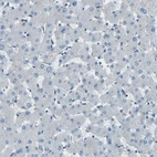 Immunohistochemical staining of human liver shows low expression as expected.