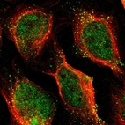 Immunofluorescent staining of human cell line U-2 OS shows localization to nucleoplasm & vesicles.