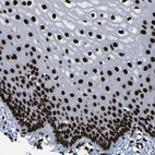 Immunohistochemical staining of human cervix, uterine shows moderate to strong nuclear positivity in glandular cells.