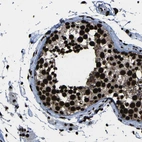 Immunohistochemical staining of human testis shows moderate to strong nuclear positivity in cells in seminiferous ducts.