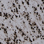Immunohistochemical staining of human cerebral cortex shows moderate to strong nuclear positivity in neurons.